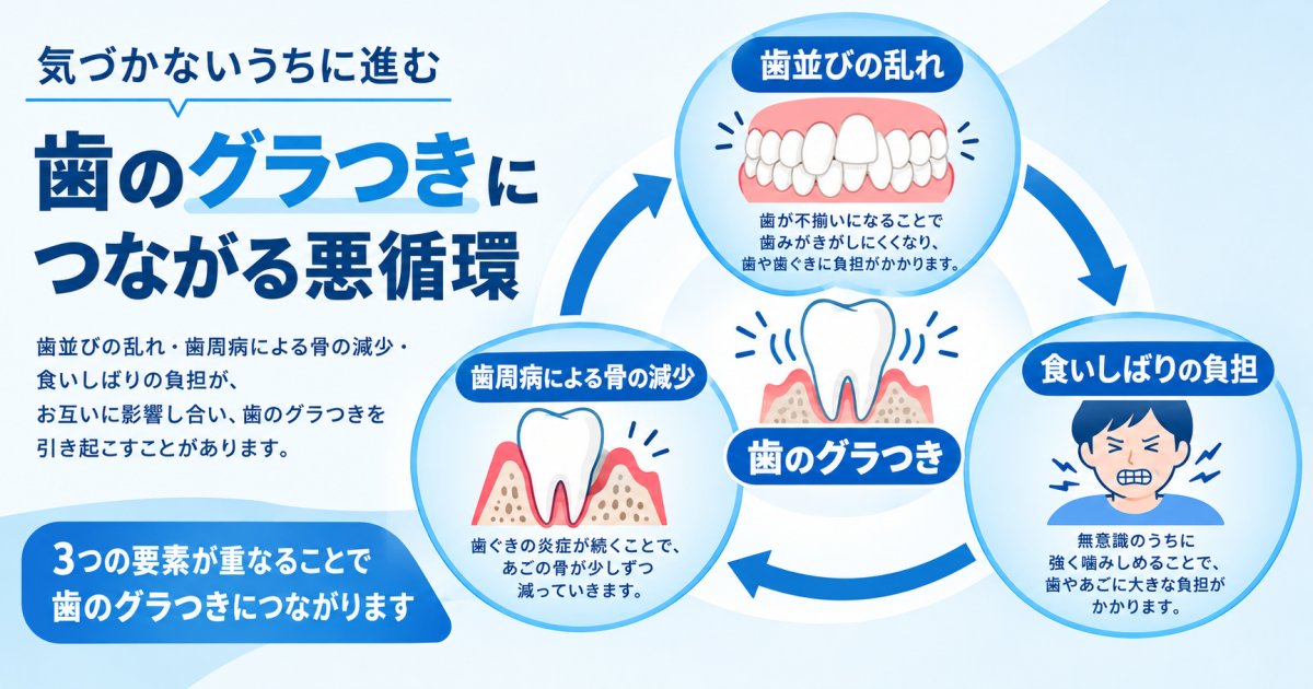 歯がグラつくのは歯周病と歯並びのどちらが原因?互いに影響し合う仕組み