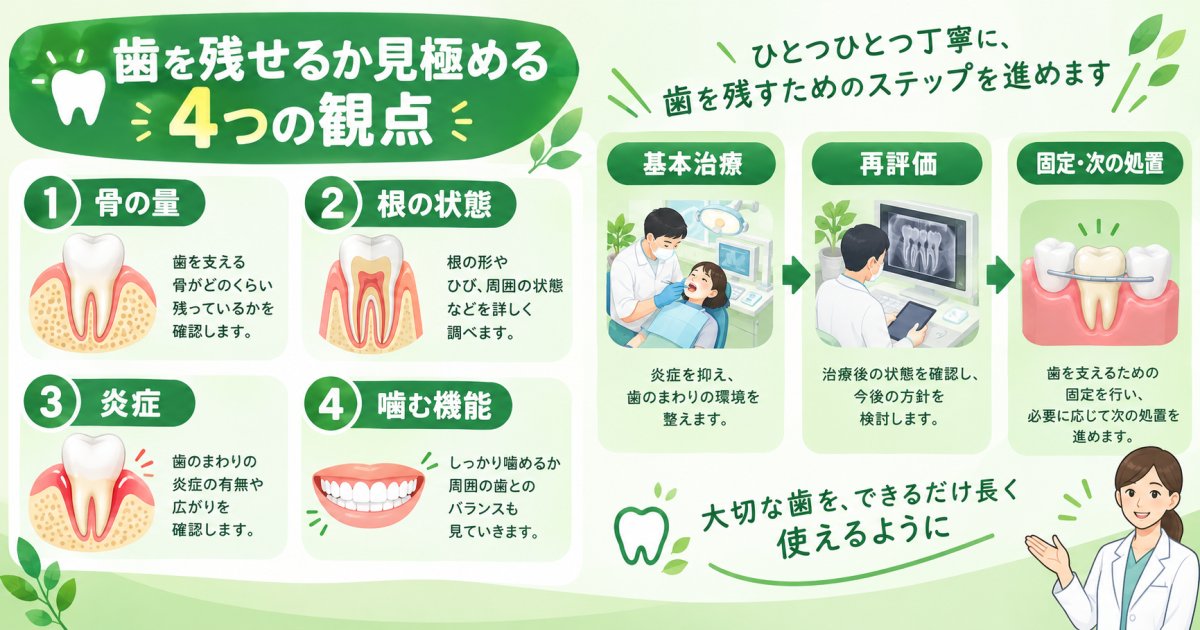 グラグラした歯は残せる?抜歯かどうかの判断基準と治療を進める順番